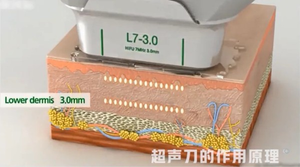 图片 2.jpg 图片 2.jpg
