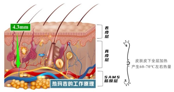 图片 3.jpg 图片 3.jpg
