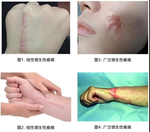 图片 1.jpg 图片 1.jpg