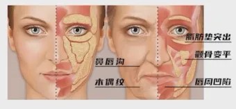 图片 3.jpg 图片 3.jpg