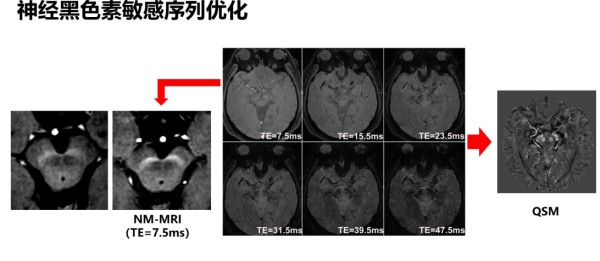 图片 4.jpg 图片 4.jpg