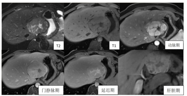 图片 4.jpg 图片 4.jpg