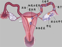 不孕症
