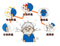 三叉神经痛