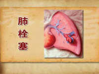 肺栓塞