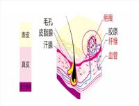 瘢痕修复