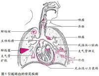 咯血