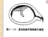 胎儿附属物异常