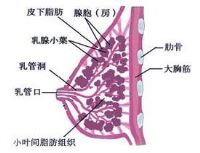 急性乳腺炎