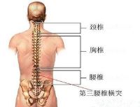 腰三横突综合征