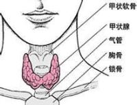 甲状腺炎