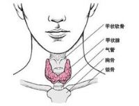 甲状旁腺功能亢进症